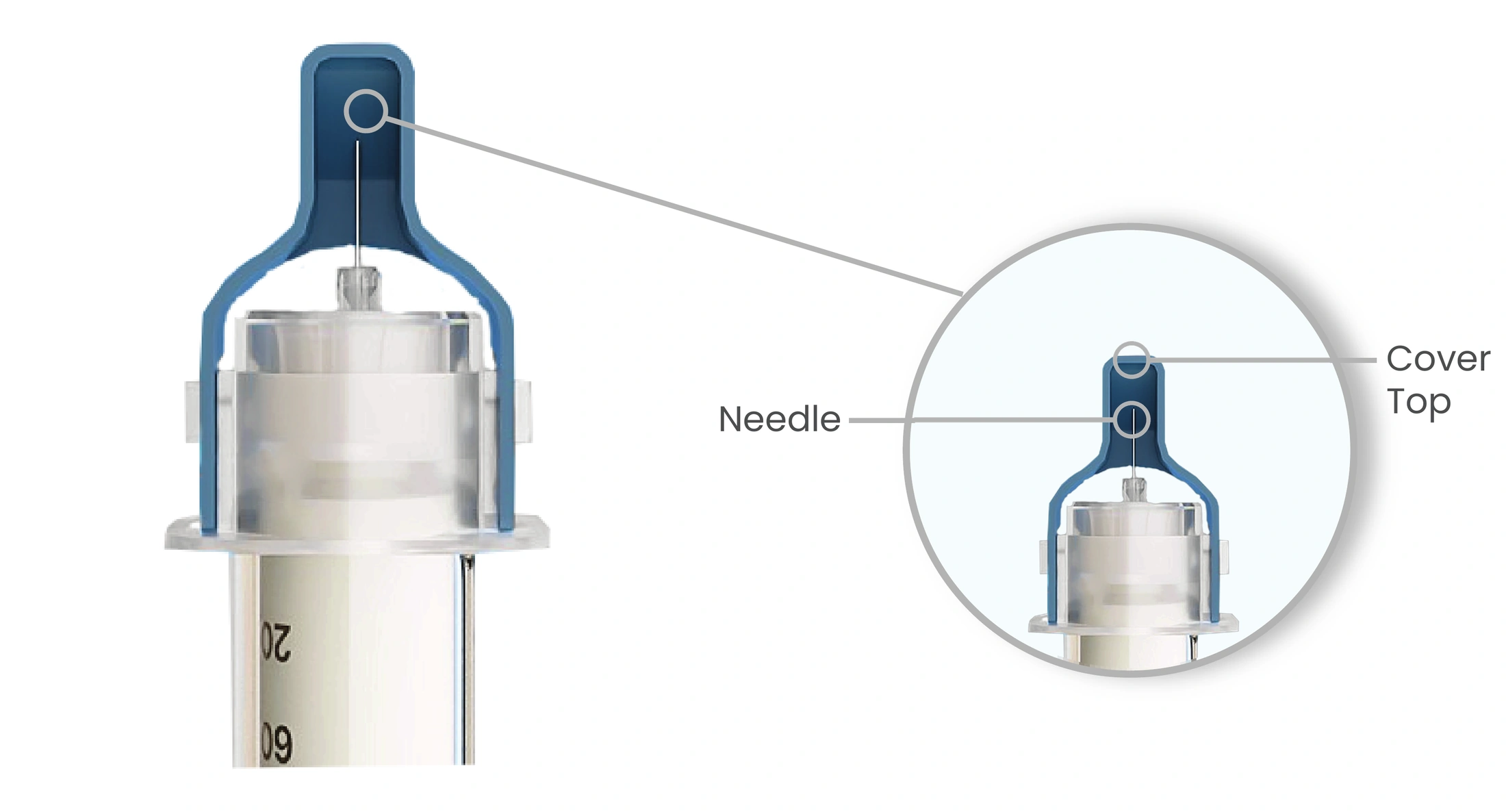 Step 2: Needle tip protection