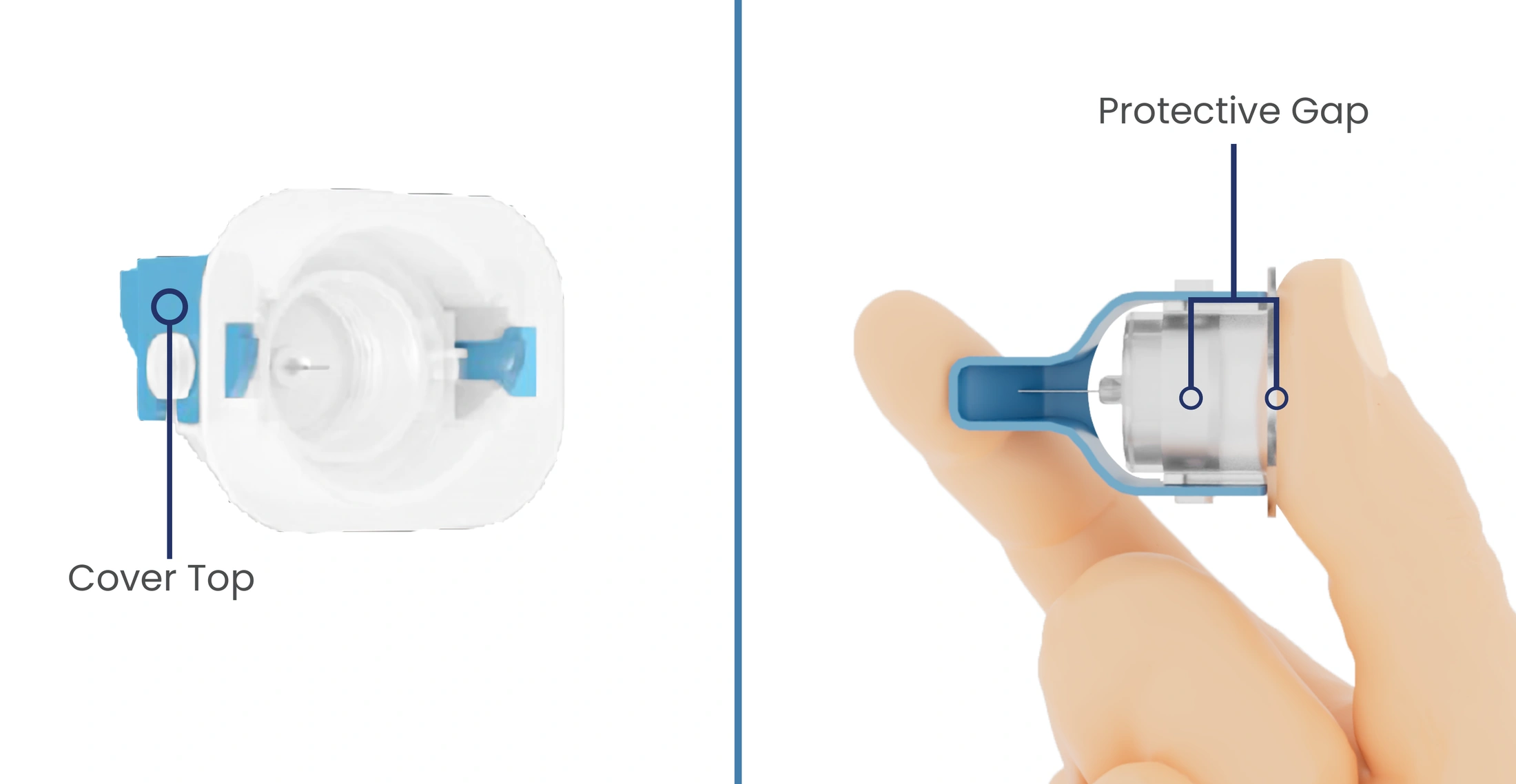 Step 4: Protective gap formation
